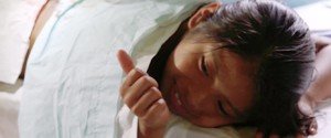 Pediatric Facial Reconstruction Patient