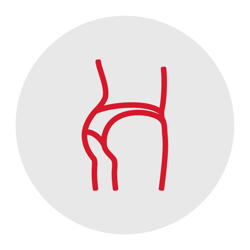 Liposuction_hips-thighs-Buttocks-icon_Corpus-christi_Rose-cosmetic-surgery-center1 - J. Keith Rose MD j Keith rose md