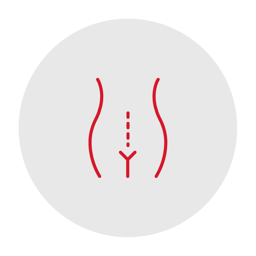Tummy-Tuck_c-section-icon_Corpus-christi_Rose-cosmetic-surgery-center1 - J. Keith Rose MD j Keith rose md